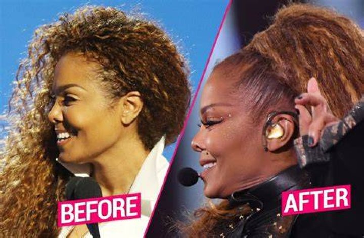 Did Janet Devlin Get A Plastic Surgery? Before and After Photos