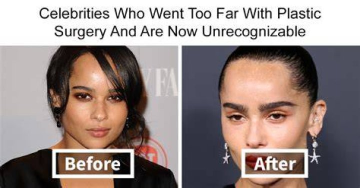 Did Sheismichaela Have A Surgery? Instagram Photos Suggests So