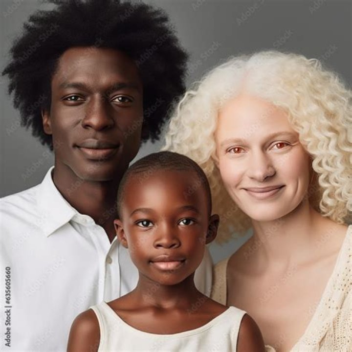If a dark-skinned woman (Bb) marries an albino man (bb) and they have four children,…