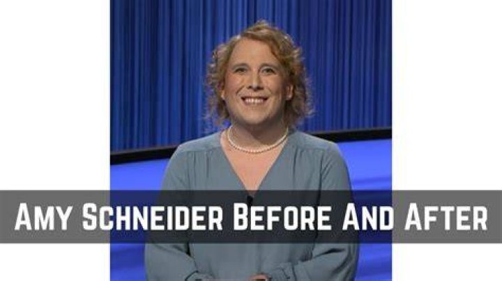 Jeopardy: Who Is Amy Schneider Girlfriend Kelly Anneken? Images Before And After Surgery On Twitter