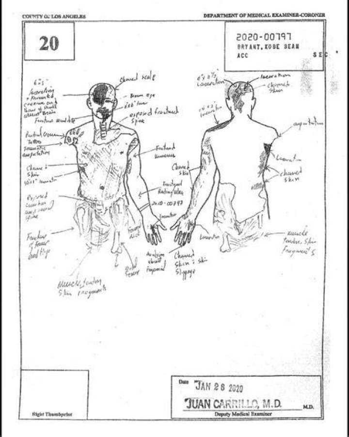 Kobe Bryant Autopsy Report and Sketch Photos From Reddit As Vanessa Bryant Trial Continues