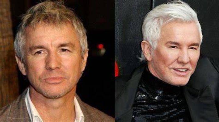 Why Does Baz Luhrmann Look So Different Now? What Has He Done To His Face?