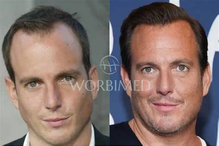 Will Arnett Weight Loss: Before And After Photos
